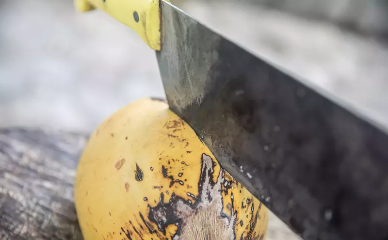 If It Bleeds, It Leads: Miami's Most Notorious Machete Attacks