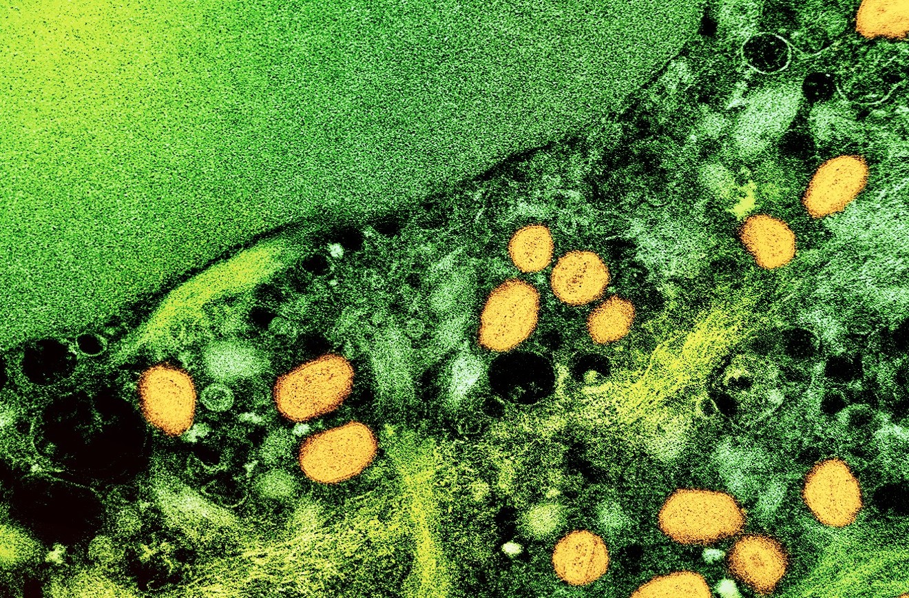 A colorized transmission electron micrograph of monkeypox particles (yellow) found within an infected cell (green)
