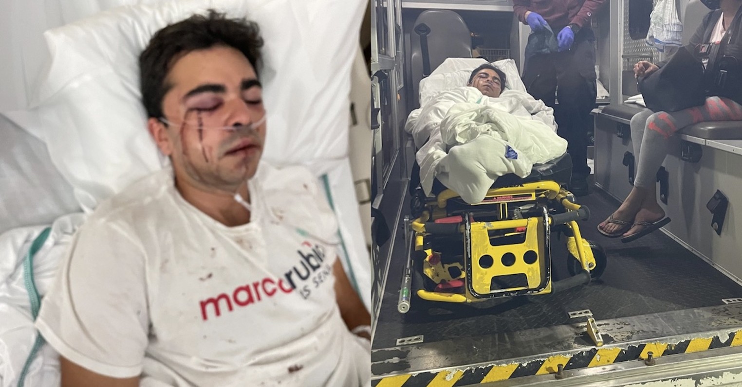 Rubio supporter, alleged former white supremacist brutally beaten in Hialeah
